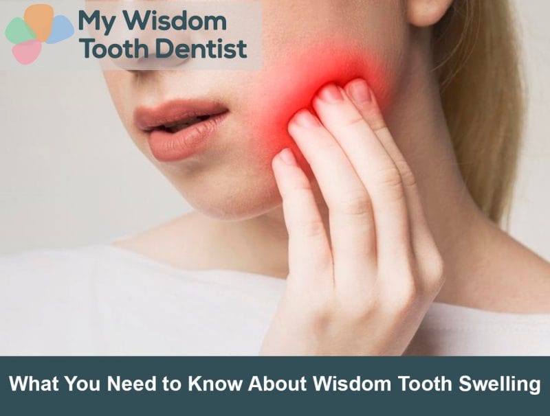 What You Need to Know About Wisdom Tooth Swelling